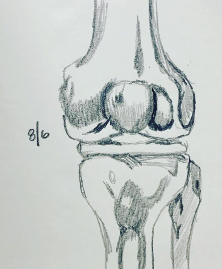 Read more about the article Day 340.