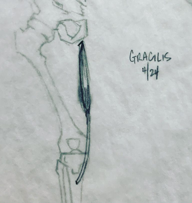 Read more about the article Day 601 part 2. Sub-butt leg musculature.