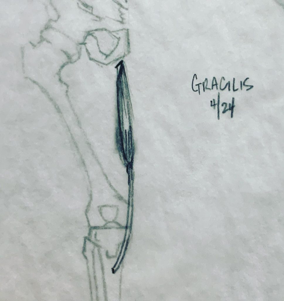 Read more about the article Day 601 part 2. Sub-butt leg musculature.