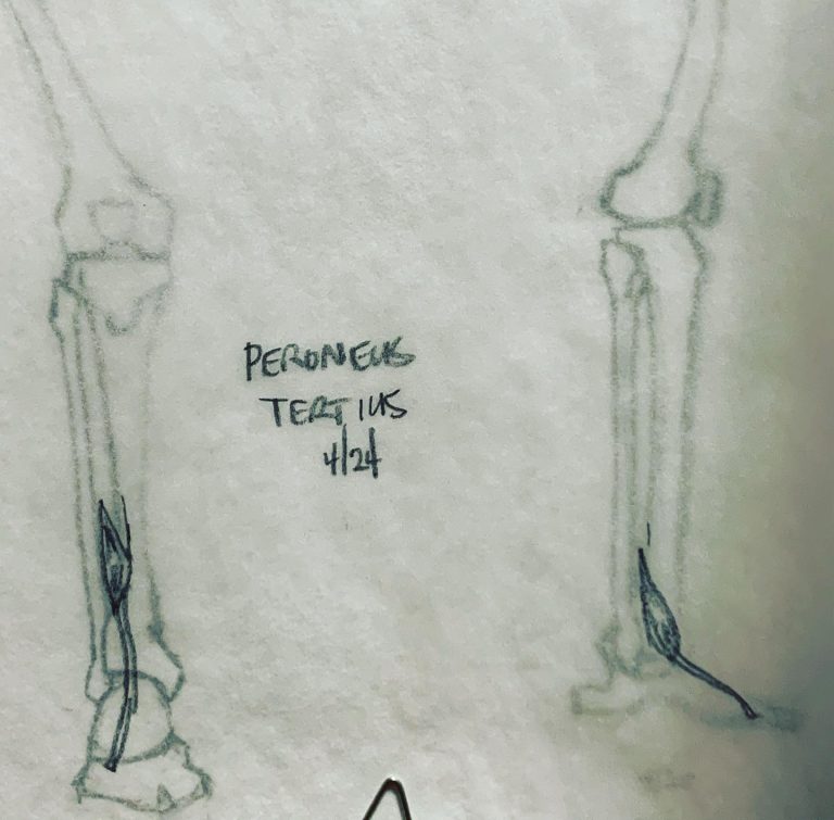 Read more about the article Day 601 part 3. Sub-butt leg musculature.